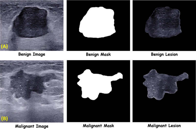 Breast Ultrasound Image Database - QAMEBI