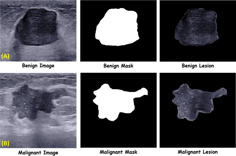 Breast Ultrasound Image Database QAMEBI